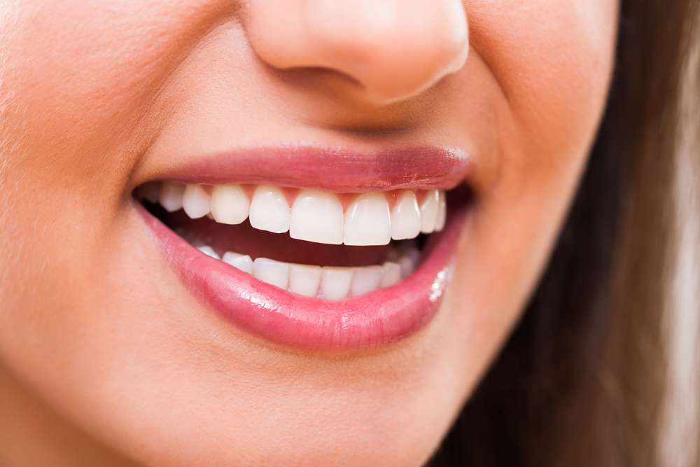 teeth whitening Toronto