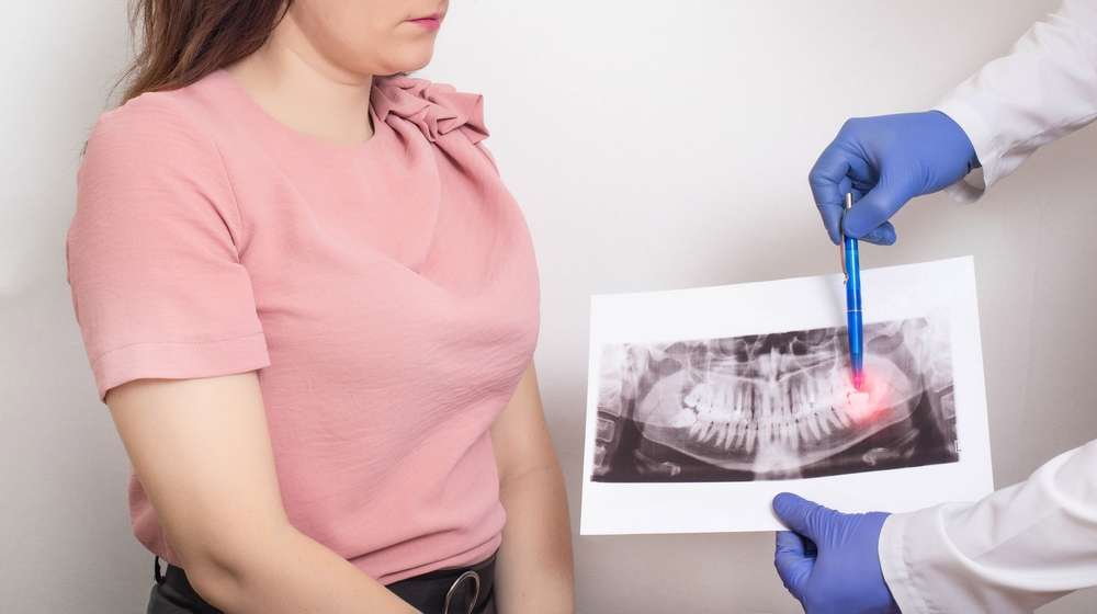 The Link Between Poor Oral Hygiene and Dental Infections