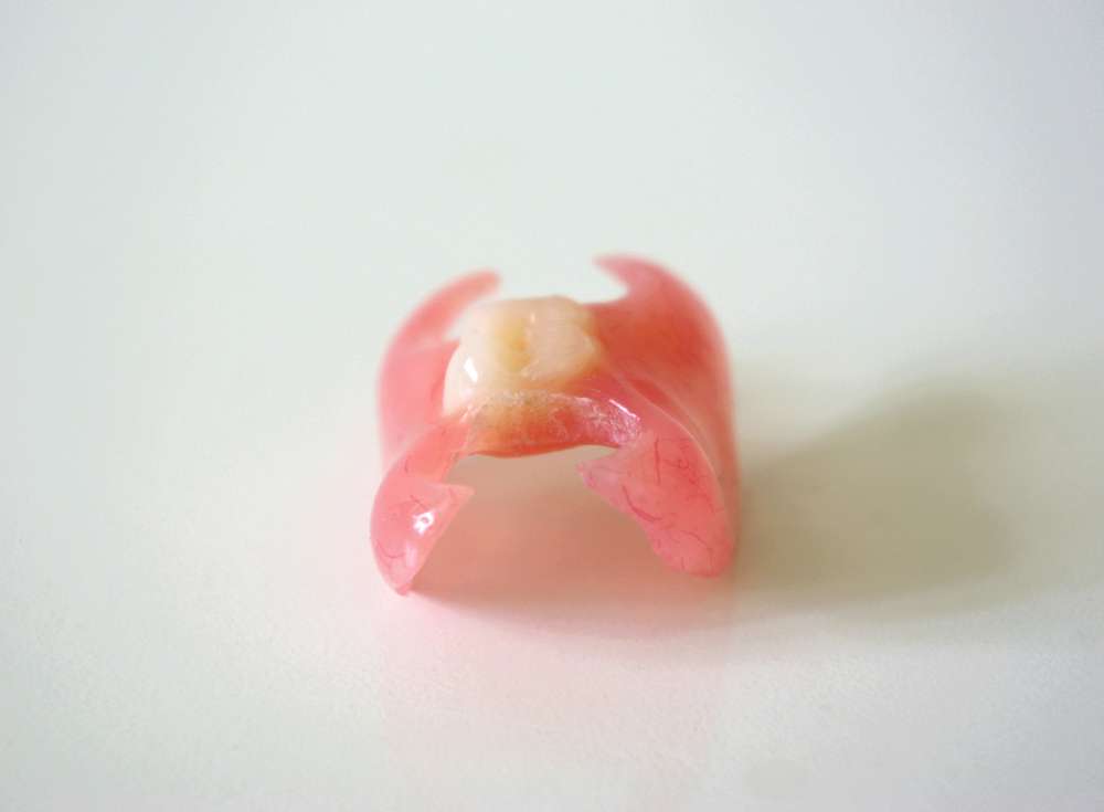 one tooth partial denture