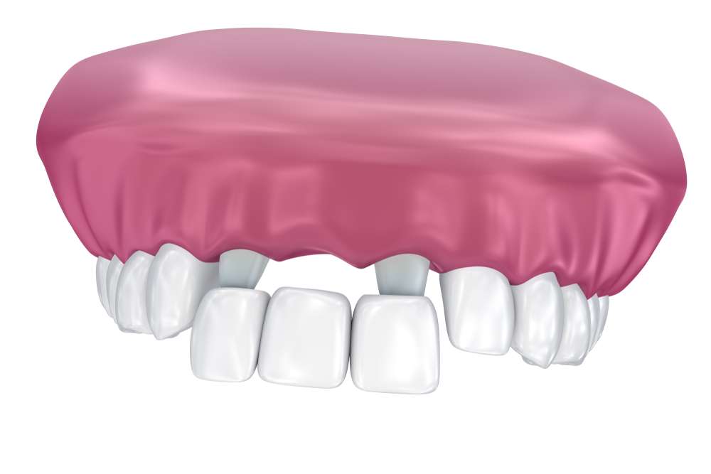 pictures of partial dentures front teeth