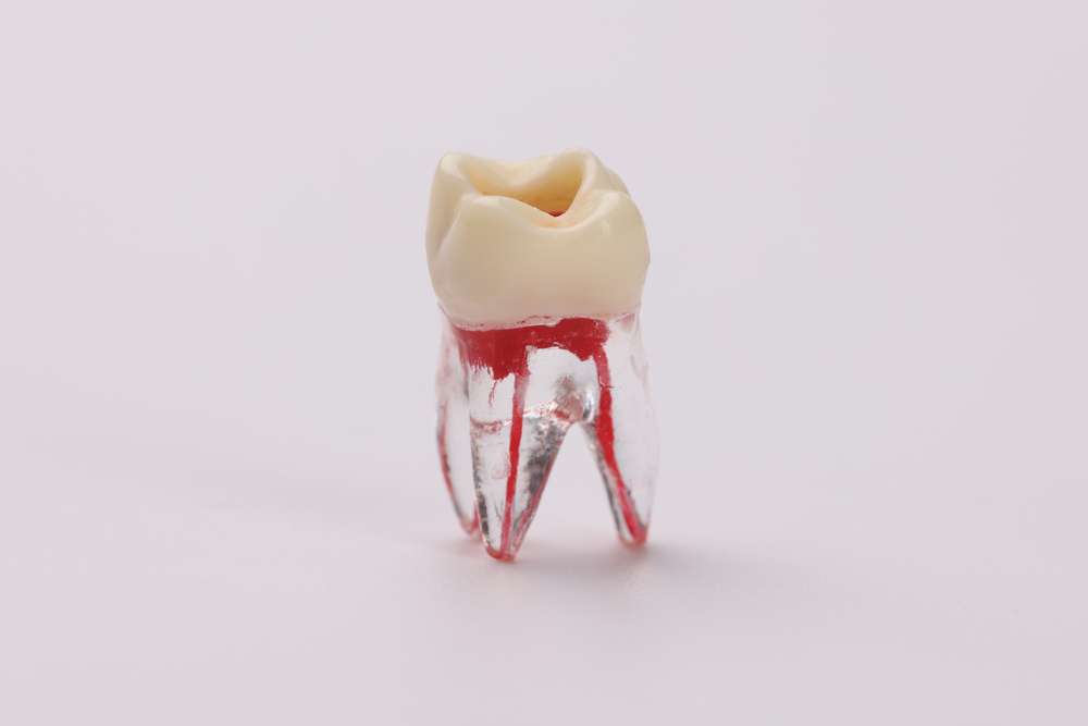 root canal recovery time