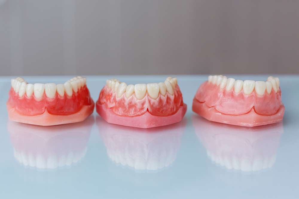 partial dentures for front teeth