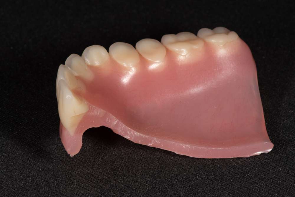 pictures of bad dentures