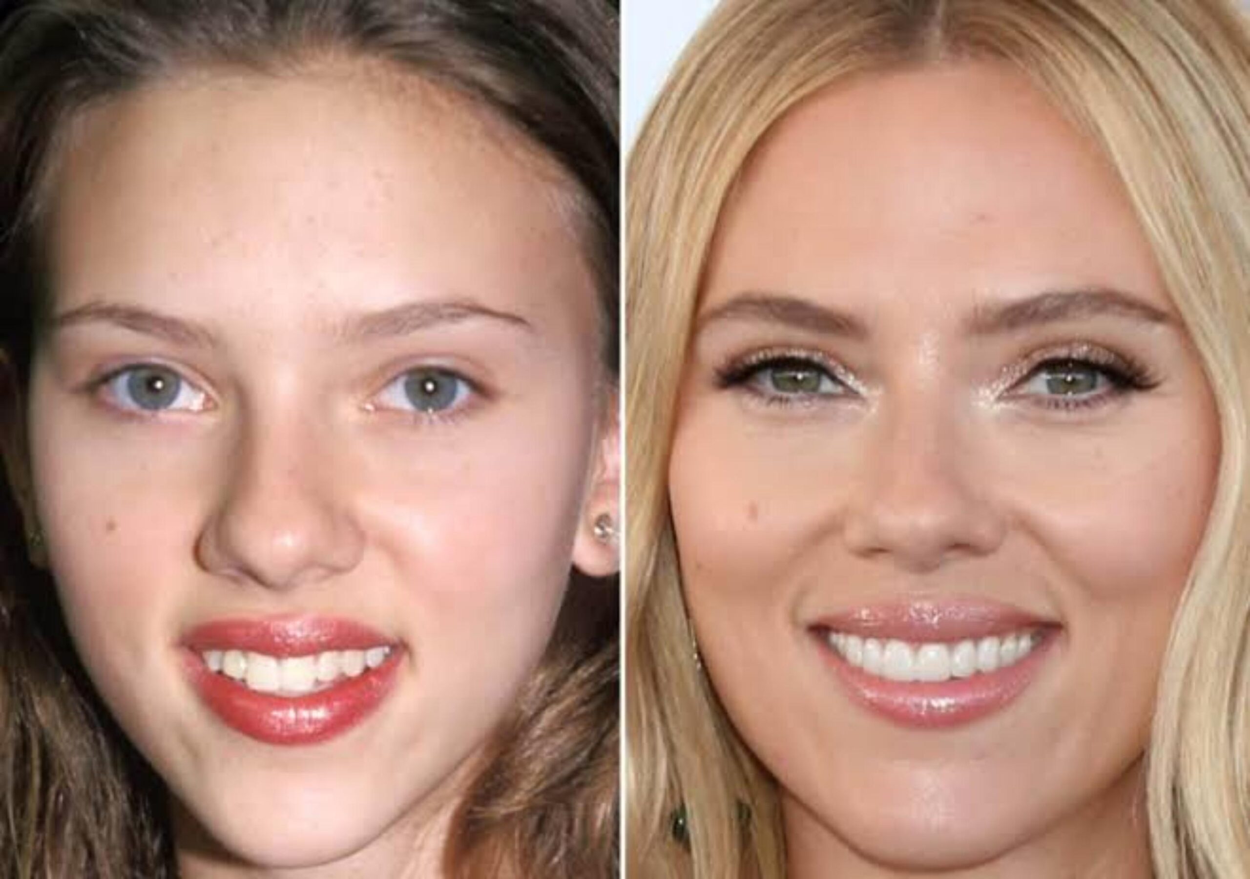 celebrity before and after dentures